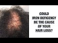 COULD IRON DEFICIENCY BE CAUSING HAIR LOSS?