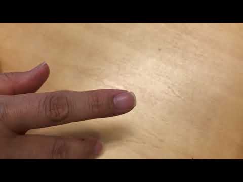 左に曲がっている爪をまっすぐに整える Youtube