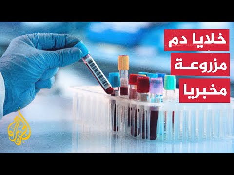 تجربة سريرية هي الأولى من نوعها في العالم..  بريطانية تتلقى خلايا دم حمراء زرعت في مختبر