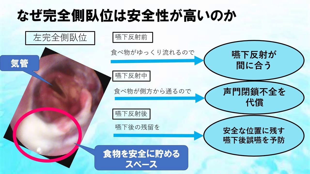3分でわかる【完全側臥位法】 ~口から食べ続けるために~ 重度嚥下障害の方でもむせずに食べられる YouTube 3分でわかる【完全側臥位法】 ~口から食べ続けるために~ 重度嚥下障害の方でもむせずに食べられる YouTube