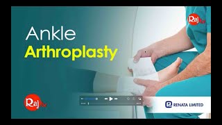 Orthopaedic Solution Academy - F&A - Ankle Arthroplasty  - Raj TV screenshot 3