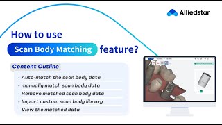 How to Use Scan Body Matching Feature