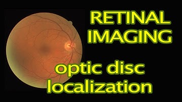 Retinal Image Processing in MATLAB: Optic Disc Localization