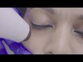 Say goodbye to Dark Circles | Armoraa | Responsible Dermatology |