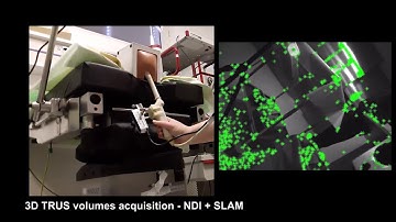 Markerless Inside-Out Tracking for 3D Ultrasound Compounding