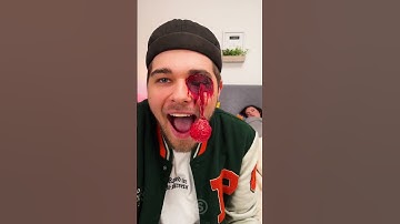 Crazy Fake Eyeball Prank #shorts