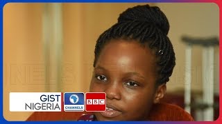 Living Good Life Without A Tibia: Story Of Beulah