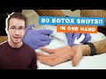Sweaty Palms? Is Botox the Ultimate Sweat Solution?