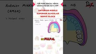 Anterior Middle Superior Alveolar Nerve Block