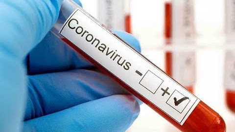 Tube test kit filling  capping machine for coronavirus