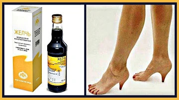 Медицинская ЖЕЛЧЬ от пяточной шпоры.