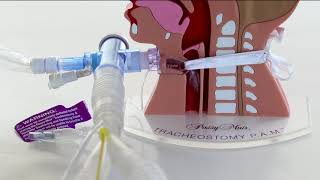 Tracheostomy PAM: Ventilator Connections   T piece