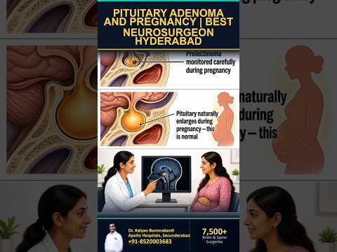 Pituitary Adenoma in Pregnancy: Is It Safe? - Best Pituitary Surgeon in Hyderabad | తెలుగు