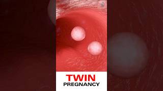 Twin Pregnancy 3D Medical Animations