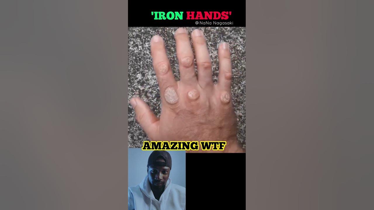 Knuckle Conditioning Training (Through Pushups) YouTube