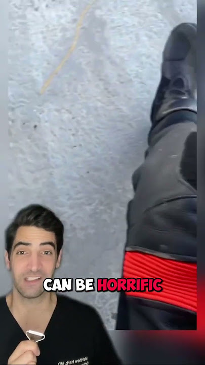 Motorcycle Crash