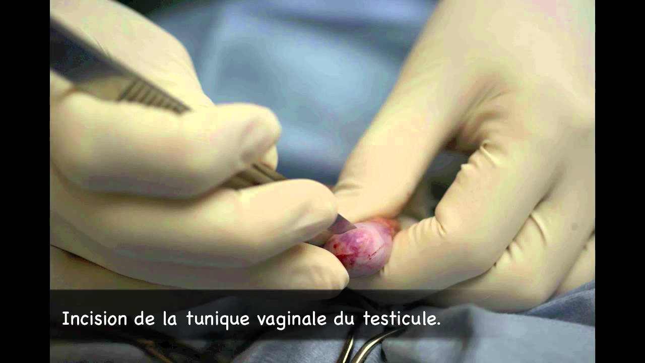 Castration Chat Youtube Castration Chat Youtube