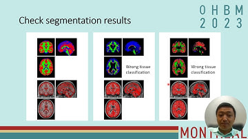 Quality control for resting-state and task fMRI in SPM