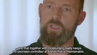 Philips BlueControl user talks about plaque psoriasis and blue light