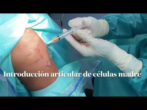Vídeo: Opciones De Tratamiento Para Retrasar La Cirugía De Rodilla