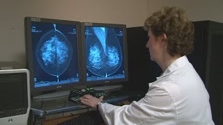 Hillcrest Hospital Works To Expand Appointment Options For Mammograms