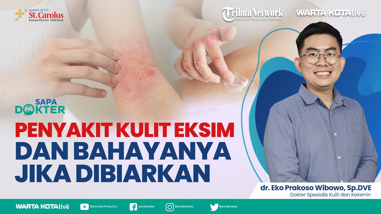 Ketahui Penyakit Kulit Eksim dan Bahayanya Jika Dibiarkan  |  Sapa Dokter