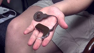 New implant may provide clearer, richer sound for people who are deaf - Science Nation