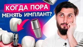 Что будет с зубными имплантами через 10 лет? Срок службы зубных имплантов