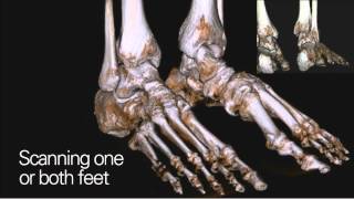 Curvebeam Pedcat True In-Office Weight Bearing Ct Imaging