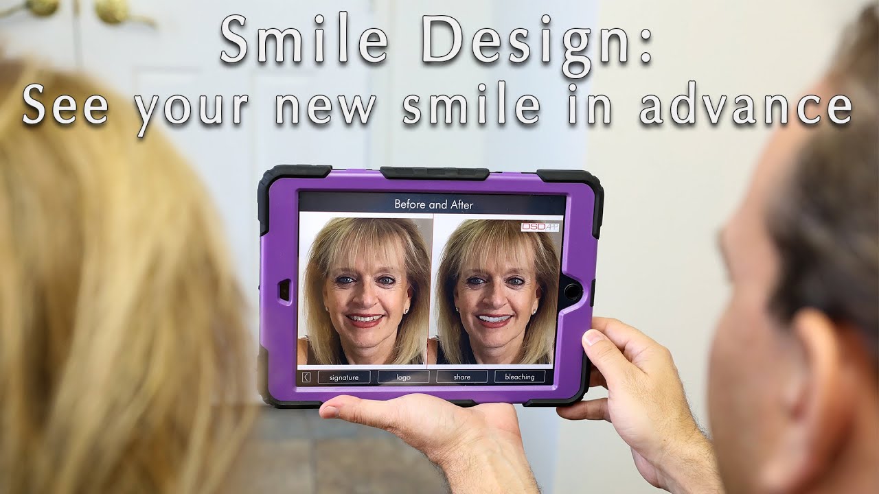 Smile Simulation - Seeing The Potential In Your Smile