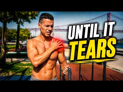Most People Ignore Their Rotator Cuff Until It Tears