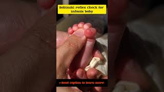 How to abnormal change for Nurvous system infants baby! #infant #child #shorts #viralshorts #youtube