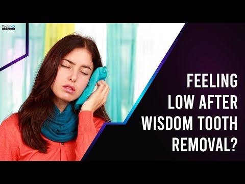 Feeling Low After Wisdom Tooth Removal