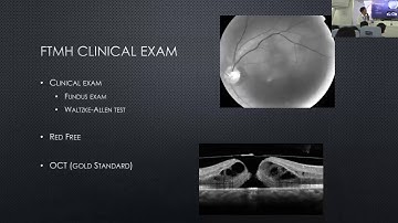 A Practical Approach to Retina OCT Interpretation: Dr. Wai-Ching Lam & Dr. Peng Yan