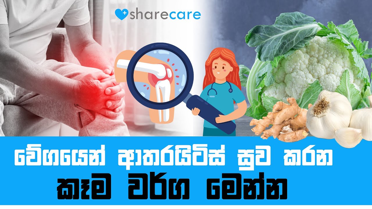 The Best Foods For Arthritis වේගයෙන් ආතරයිටිස් සුව කරන කෑම වර්ග මෙන්න