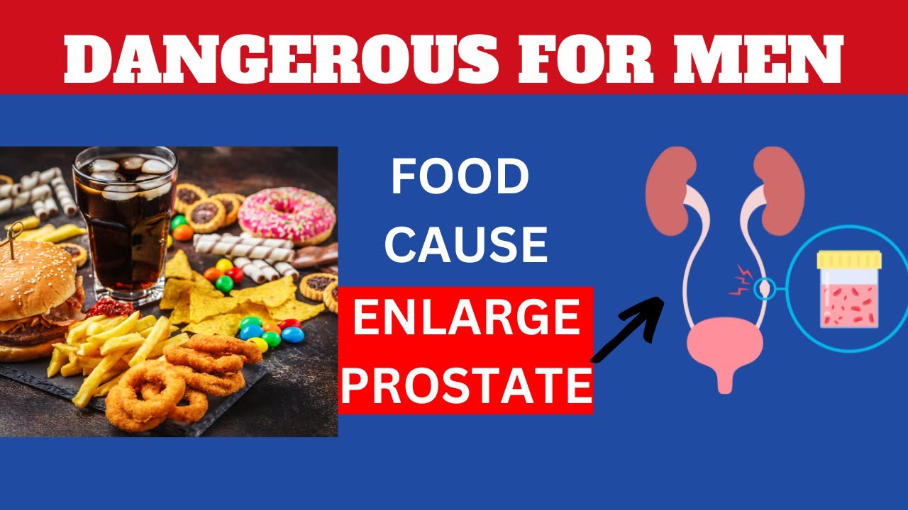 TOP 5 FOODS THAT CAUSE ENLARGED PROSTATE AVOID THEM. Health YouTube