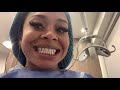 PORCELAIN VENEERS VLOG