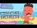 Understanding Sunburns