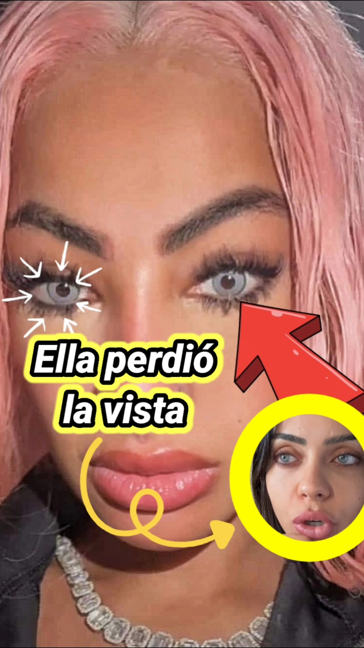 Ella perdió la vista. #yailinlamásviral