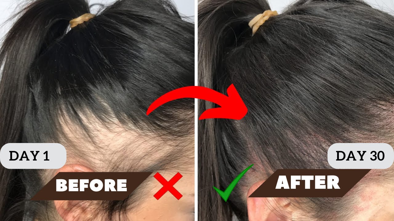 How To Get Thicker Longer and Softer hair | 30 days challenge with ...