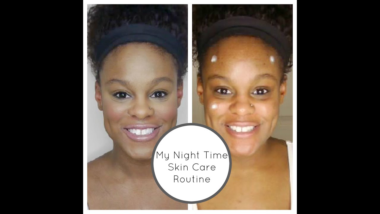 apple cider vinegar for hyperpigmentation