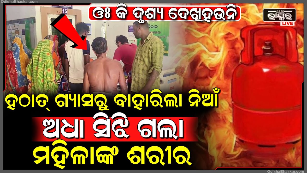 ରୋଷେଇ କରୁଥିବା ବେଳେ ଲୁଗାରେ ଲାଗିଲା ନିଆଁ । ଶରୀରର ୫୦ପ୍ରତିଶତ ପୋଡିଯାଇଥିବା ଦେଖିବାକୁ ମିଳିଛି ।