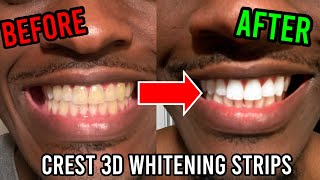 Using Crest 3D Whitestrips in 2022 *Honest Review* | How to Whiten Yellow Teeth