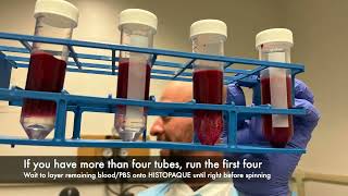 Fields Lab - Pbmc Isolation