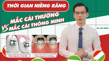 So sánh thời gian niềng răng mắc cài thường với mắc cài thông minh ( tự buộc)