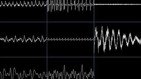 Z2: Pre-chaos - Remastered