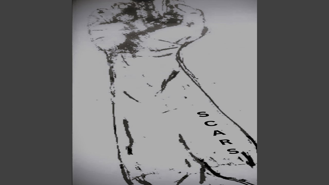 Watch Scars on YouTube Watch Scars on YouTube