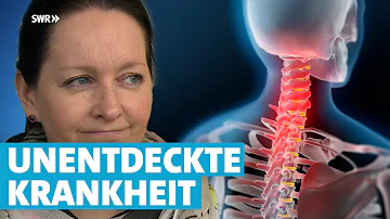 Ist ein HWS-Syndrom heilbar?