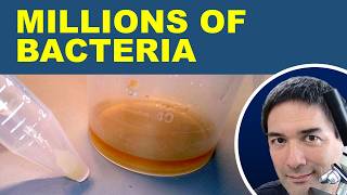🔬I have grown bacteria in Urine and put them under the microscope