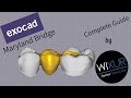 Exocad - Maryland Bridge (metal-free)